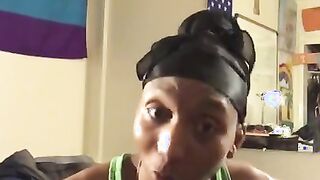 PrincexXx Diaries daddy-daddy Top Surgery Review papa(7/29/19)